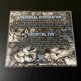 Cerebral Suppuration/Oxcipital Pus - Pus Cerebral.... - SPLIT USA